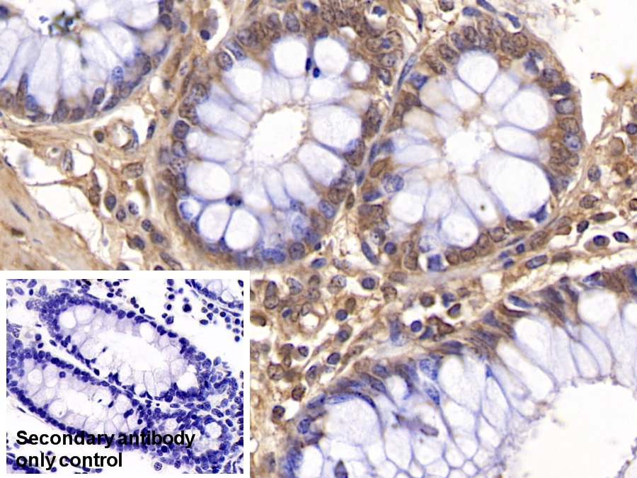 Monoclonal Antibody to Visfatin (VF)