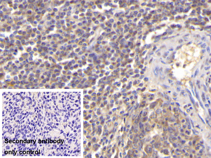 Monoclonal Antibody to Visfatin (VF)