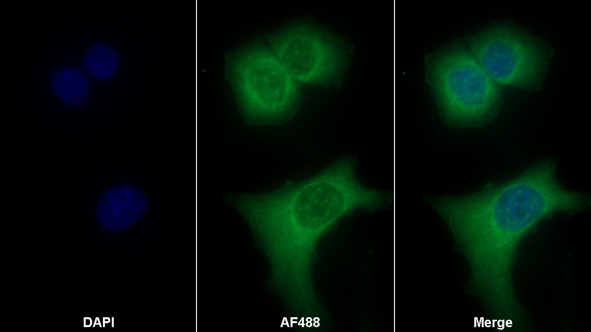 Monoclonal Antibody to Visfatin (VF)