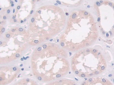 Monoclonal Antibody to Cross Linked N-Telopeptide Of Type I Collagen (NTXI)