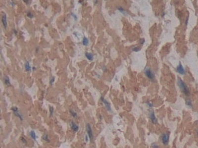 Monoclonal Antibody to Cross Linked N-Telopeptide Of Type I Collagen (NTXI)