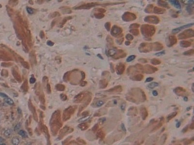 Monoclonal Antibody to Cross Linked N-Telopeptide Of Type I Collagen (NTXI)