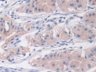 Monoclonal Antibody to Cross Linked N-Telopeptide Of Type I Collagen (NTXI)