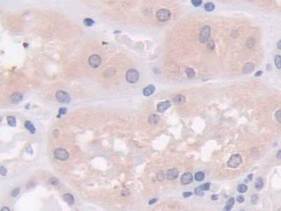 Monoclonal Antibody to Cross Linked N-Telopeptide Of Type I Collagen (NTXI)