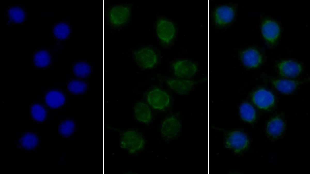 Monoclonal Antibody to Complement component 1 Q subcomponent-binding protein, mitochondrial (C1QBP)