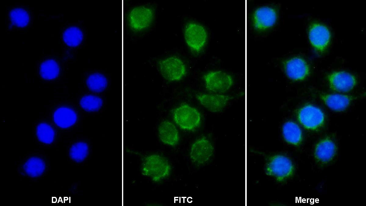 Monoclonal Antibody to Complement component 1 Q subcomponent-binding protein, mitochondrial (C1QBP)