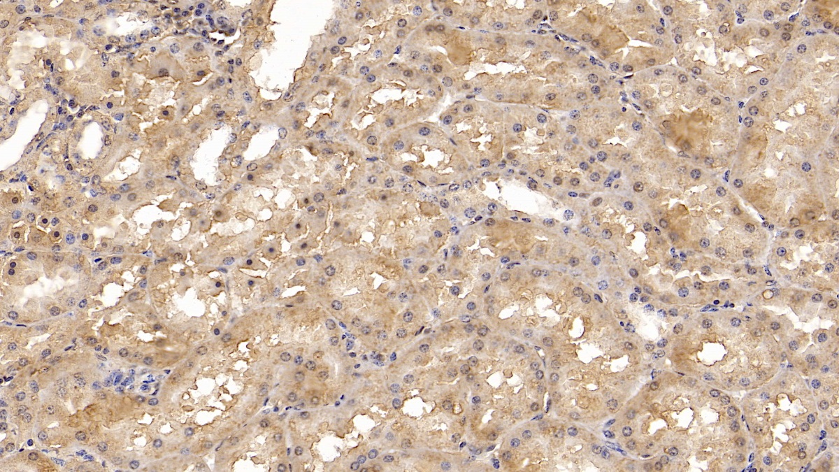 Monoclonal Antibody to Complement component 1 Q subcomponent-binding protein, mitochondrial (C1QBP)