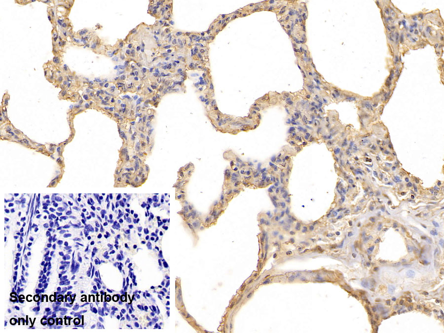 Monoclonal Antibody to Complement component 1 Q subcomponent-binding protein, mitochondrial (C1QBP)