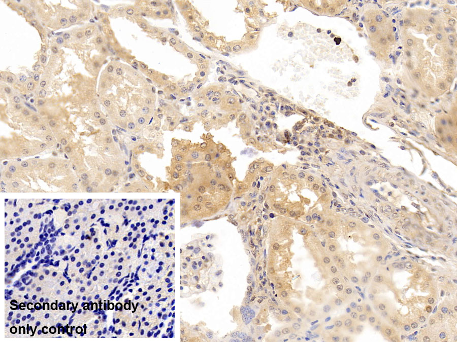 Monoclonal Antibody to Complement component 1 Q subcomponent-binding protein, mitochondrial (C1QBP)