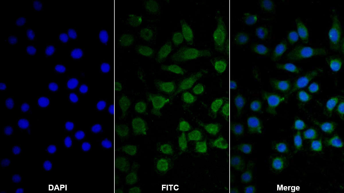 Monoclonal Antibody to Complement component 1 Q subcomponent-binding protein, mitochondrial (C1QBP)