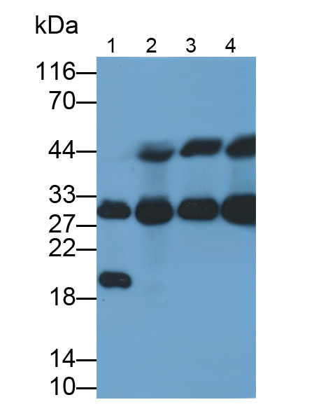 Monoclonal Antibody to Complement component 1 Q subcomponent-binding protein, mitochondrial (C1QBP)