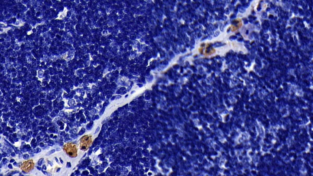 Monoclonal Antibody to Toll Like Receptor 2 (TLR2)