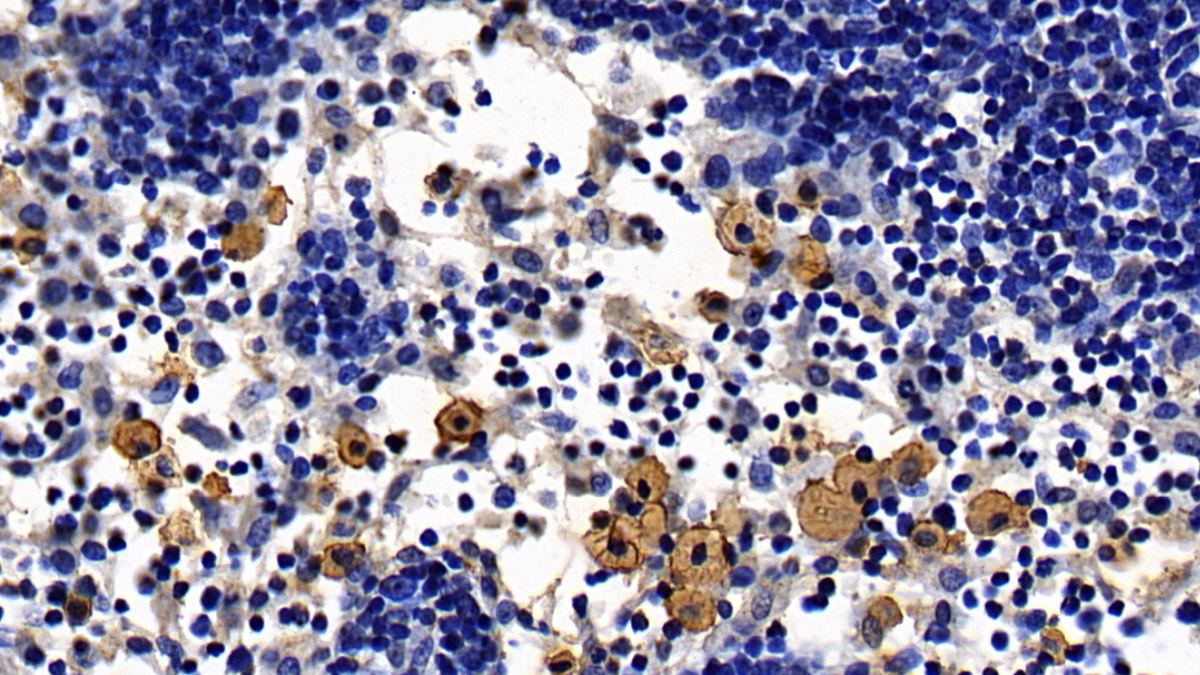 Monoclonal Antibody to Toll Like Receptor 2 (TLR2)