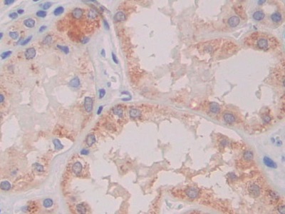 Monoclonal Antibody to Cross Linked C-Telopeptide Of Type I Collagen (CTXI)