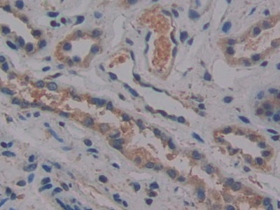 Monoclonal Antibody to Cross Linked C-Telopeptide Of Type I Collagen (CTXI)