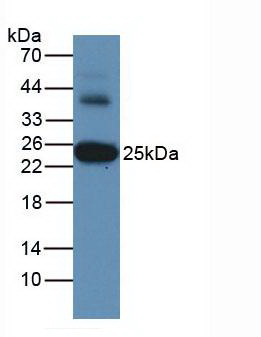 Monoclonal Antibody to Glutathione S Transferase Alpha 3 (GSTa3)