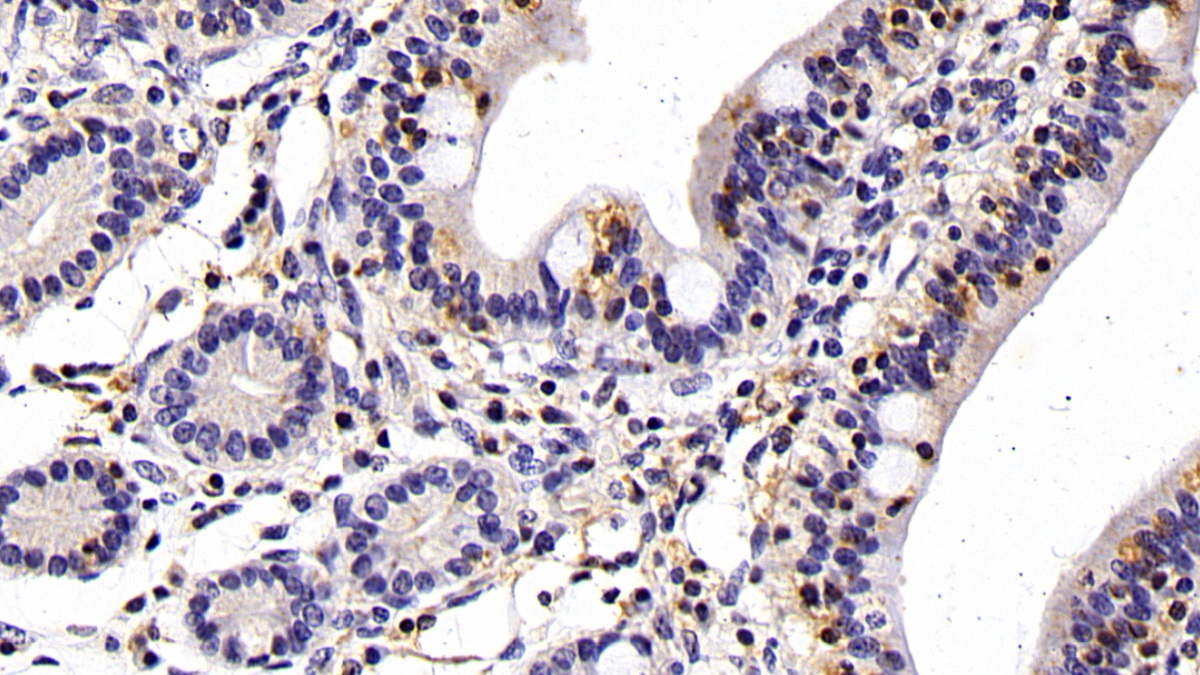 Monoclonal Antibody to Cluster Of Differentiation 14 (CD14)