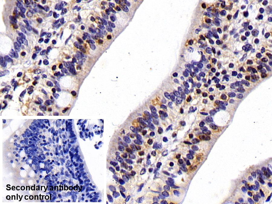 Monoclonal Antibody to Cluster Of Differentiation 14 (CD14)