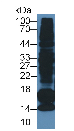 Monoclonal Antibody to Procalcitonin (PCT)