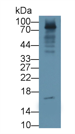 Monoclonal Antibody to Procalcitonin (PCT)