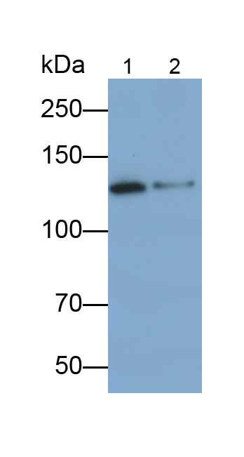 Monoclonal Antibody to Neuropilin 1 (NRP1)