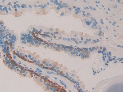 Monoclonal Antibody to Heat Shock Protein 27 (Hsp27)