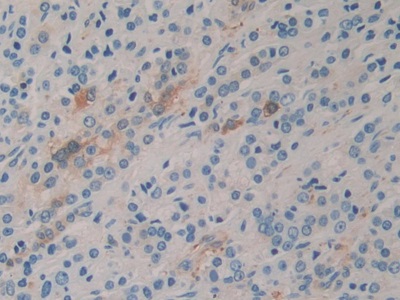 Monoclonal Antibody to Heat Shock Protein 27 (Hsp27)