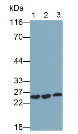 Monoclonal Antibody to Heat Shock Protein 27 (Hsp27)