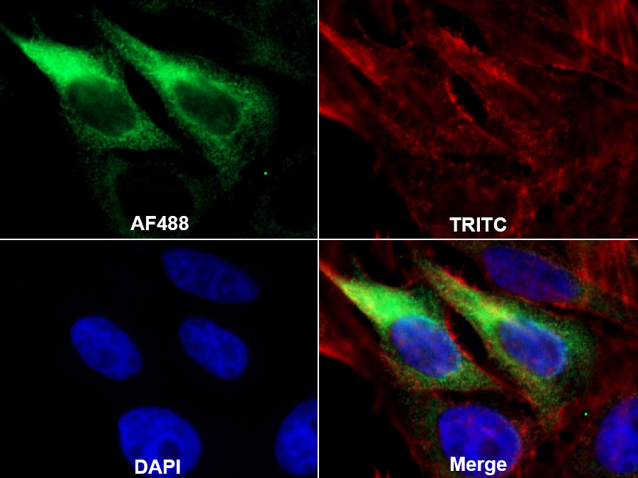 Monoclonal Antibody to Heat Shock Protein 27 (Hsp27)