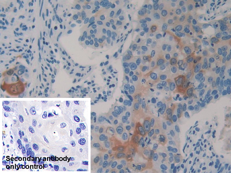 Monoclonal Antibody to Heat Shock Protein 27 (Hsp27)