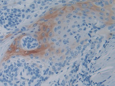 Monoclonal Antibody to Heat Shock Protein 27 (Hsp27)