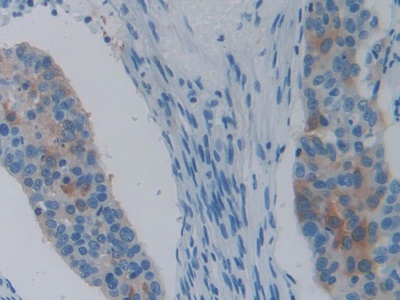 Monoclonal Antibody to Heat Shock Protein 27 (Hsp27)