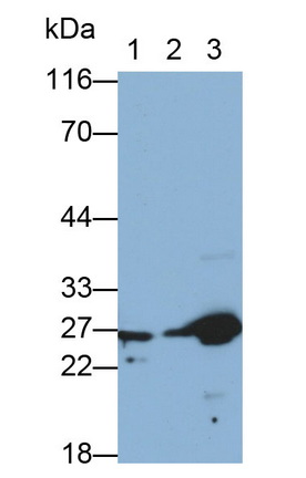 Monoclonal Antibody to Heat Shock Protein 27 (Hsp27)