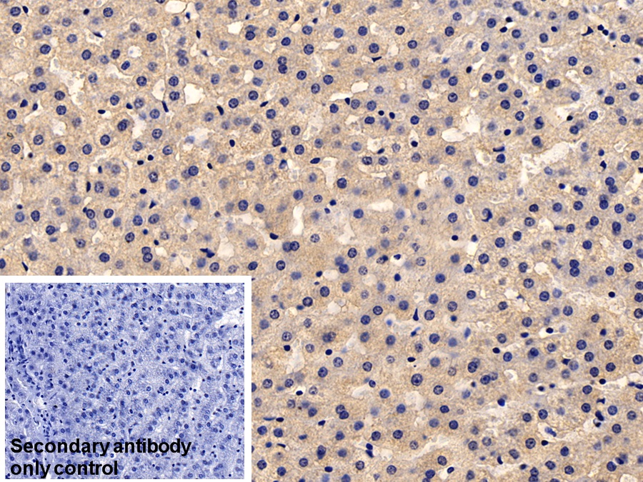 Monoclonal Antibody to Heat Shock Protein 27 (Hsp27)