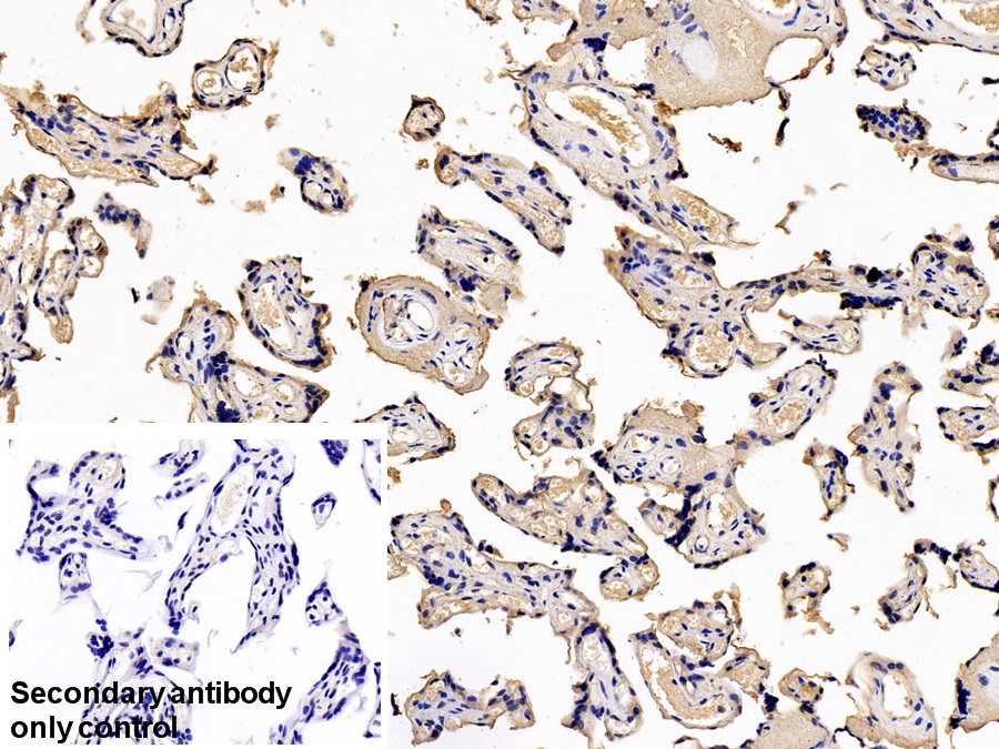 Monoclonal Antibody to Heat Shock Protein 27 (Hsp27)