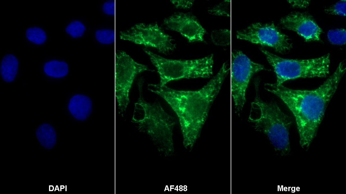 Monoclonal Antibody to Heat Shock Protein 27 (Hsp27)