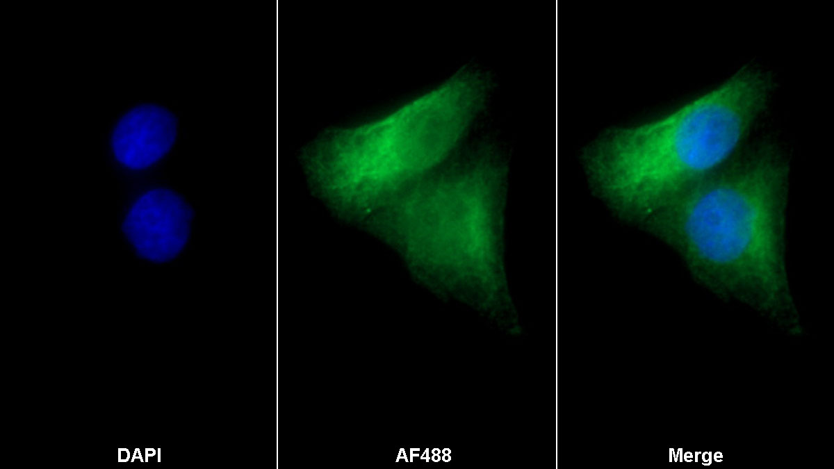 Monoclonal Antibody to Membrane Protein, Palmitoylated 6 (MPP6)