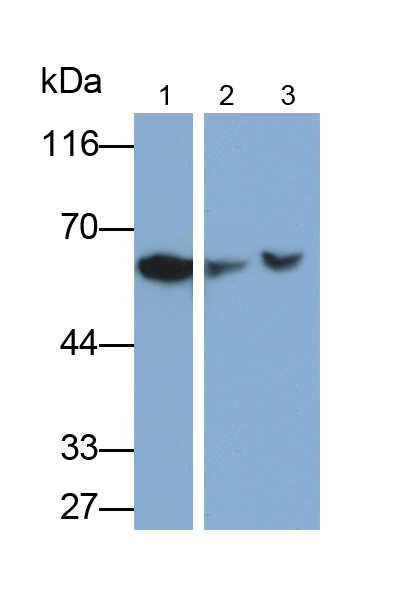 Monoclonal Antibody to Membrane Protein, Palmitoylated 6 (MPP6)