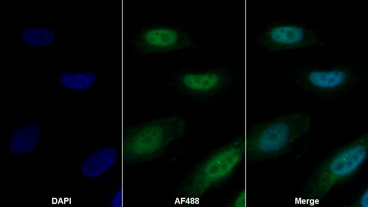 Monoclonal Antibody to Thioredoxin (Trx)