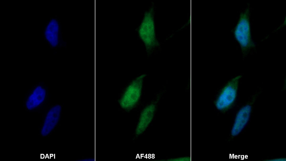 Monoclonal Antibody to Thioredoxin (Trx)