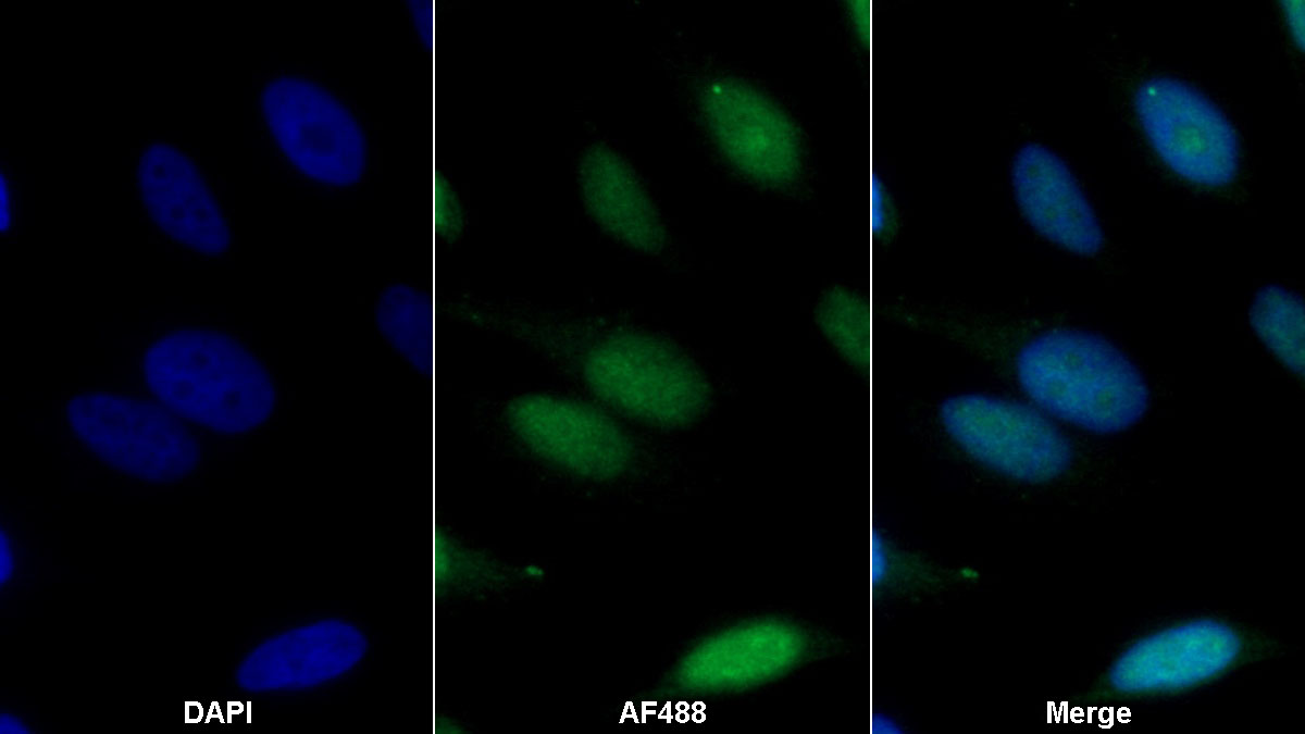 Monoclonal Antibody to Thioredoxin (Trx)