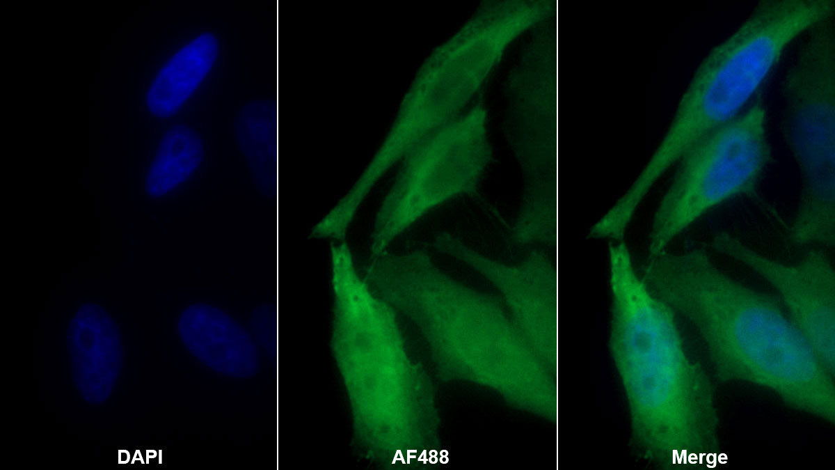 Monoclonal Antibody to Thioredoxin (Trx)