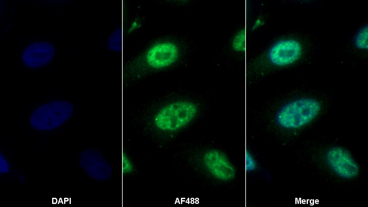 Monoclonal Antibody to Thioredoxin (Trx)