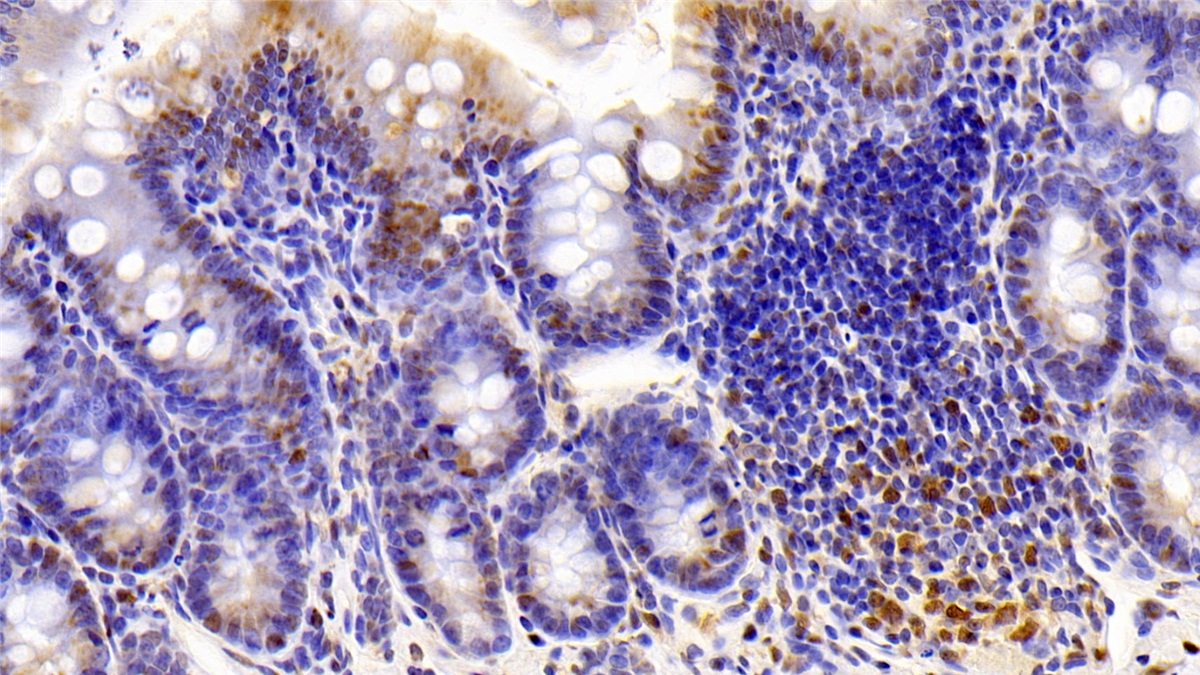 Monoclonal Antibody to Thioredoxin (Trx)