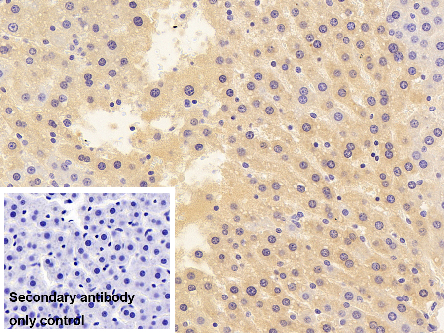 Monoclonal Antibody to Apolipoprotein E (APOE)