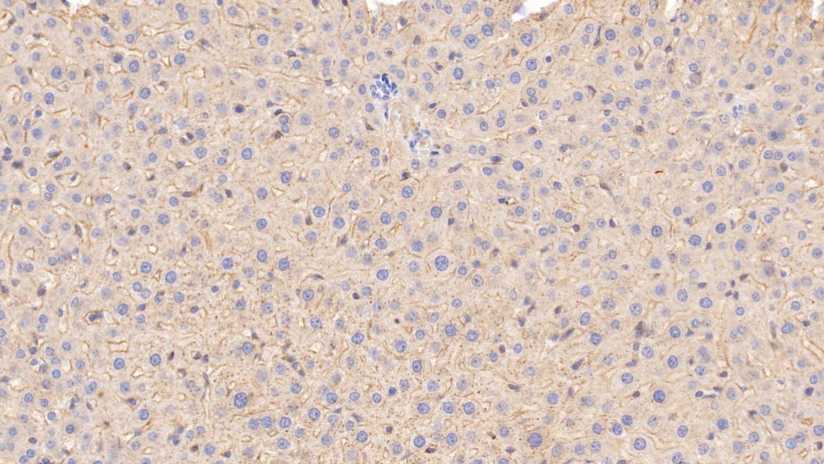 Monoclonal Antibody to Apolipoprotein E (APOE)