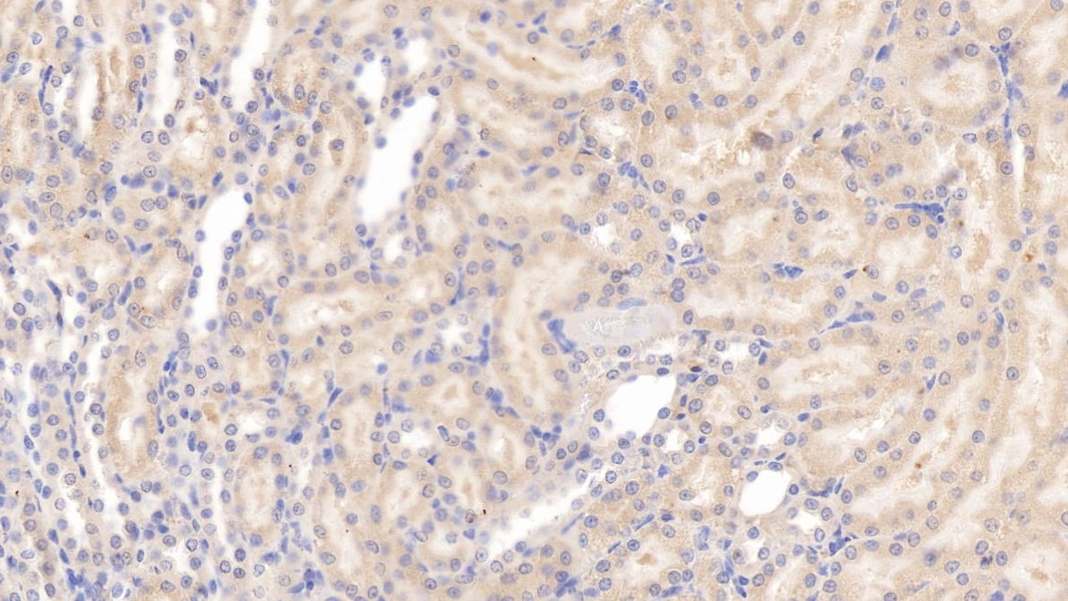 Monoclonal Antibody to Apolipoprotein E (APOE)