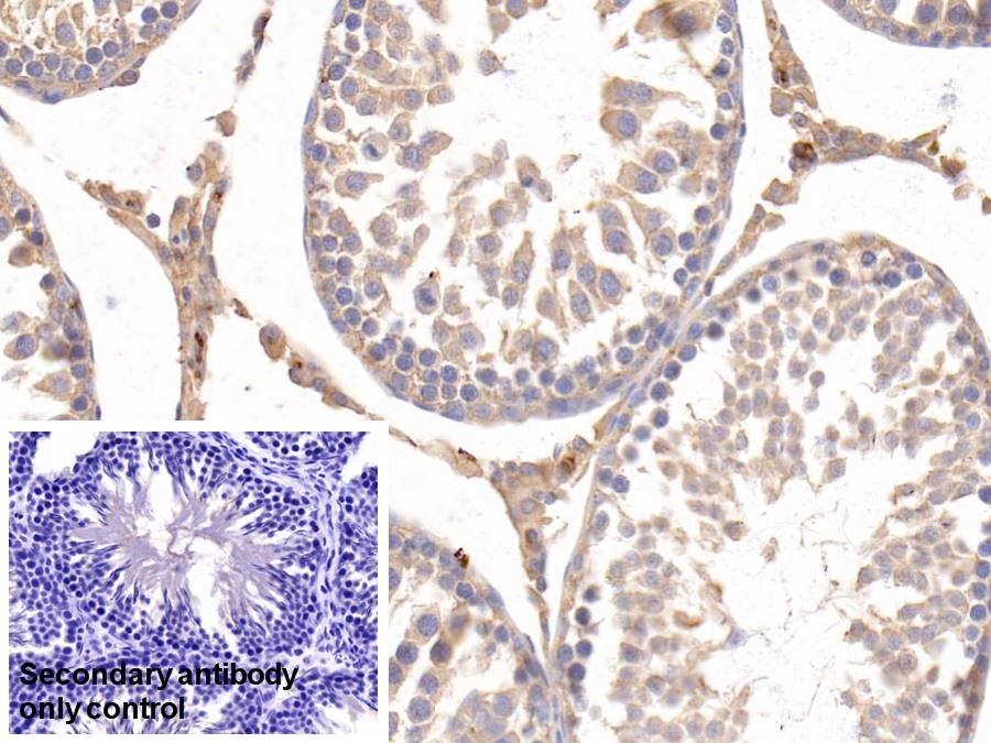 Monoclonal Antibody to Apolipoprotein E (APOE)