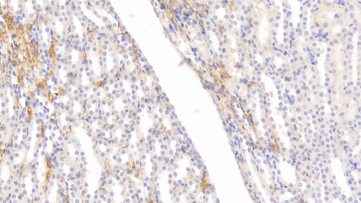 Monoclonal Antibody to Apolipoprotein E (APOE)