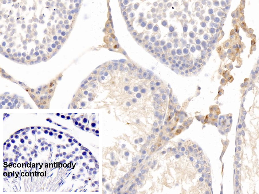 Monoclonal Antibody to Apolipoprotein E (APOE)